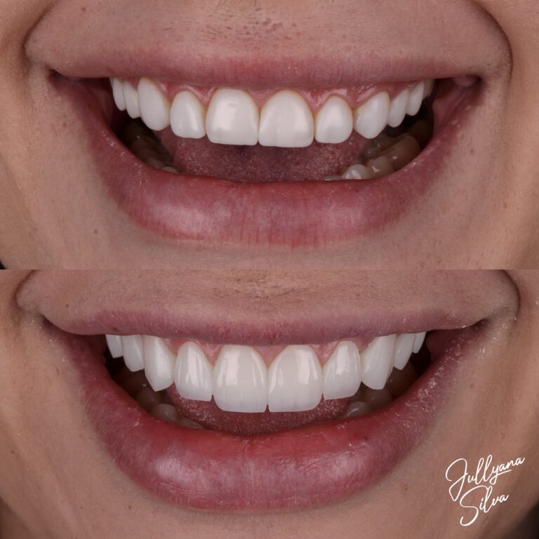 Facetune_11-09-2024-22-14-47