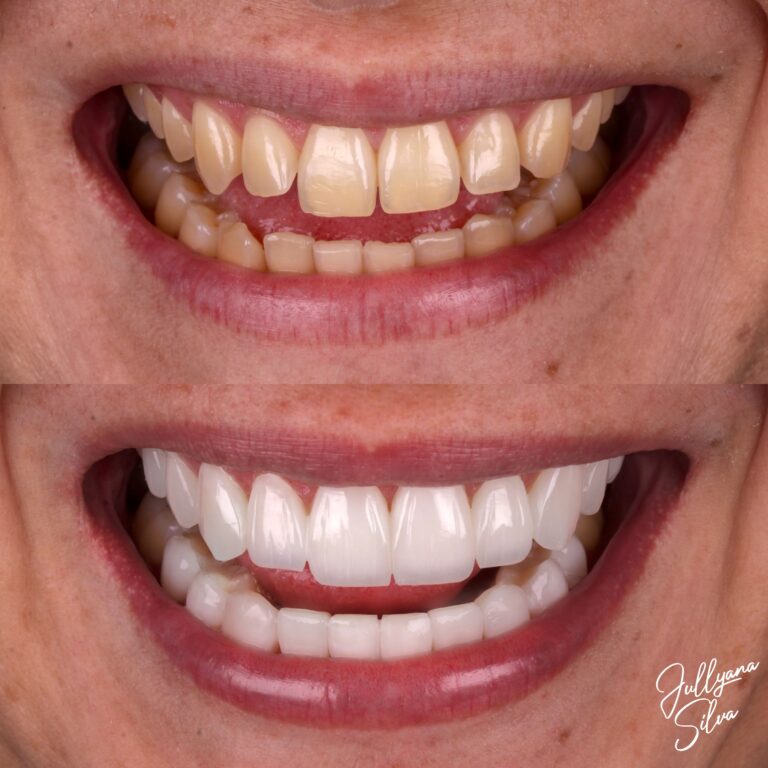 photo-output